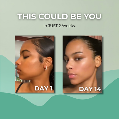 Clearli Lymphatic Drainage Drops